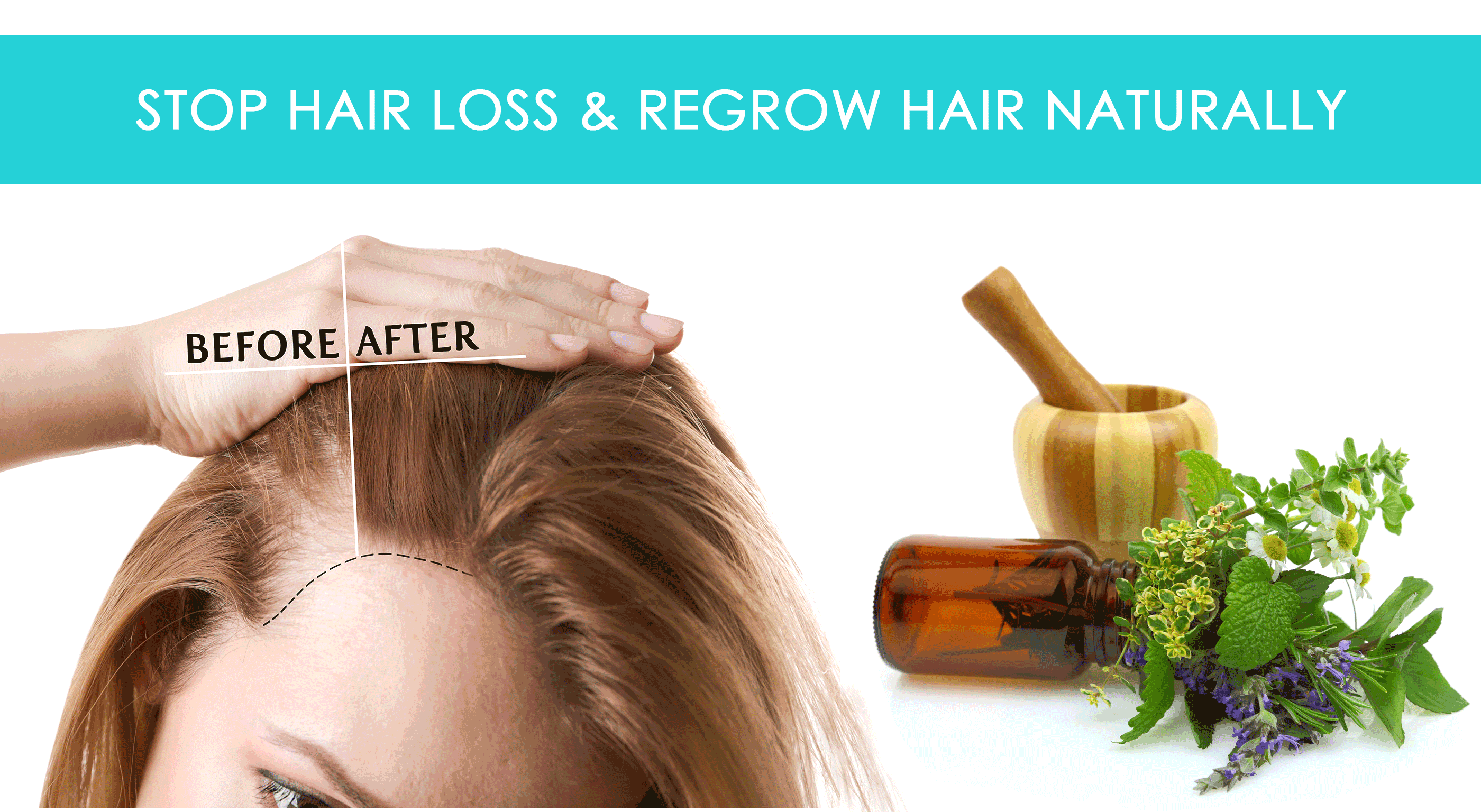 how to stop hair loss remedies