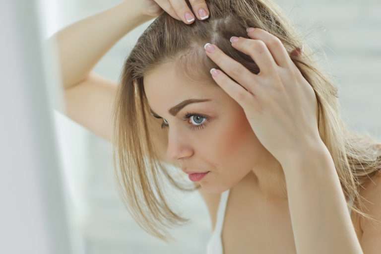 Does Dandruff Cause Hair Loss? Everything you Should Know